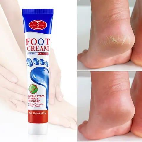 Aichun Beauty Moisturizing Foot Cream, Dead Skin Care Cream, Foot Removal Cream For Cracked Heels 20g Ac2042