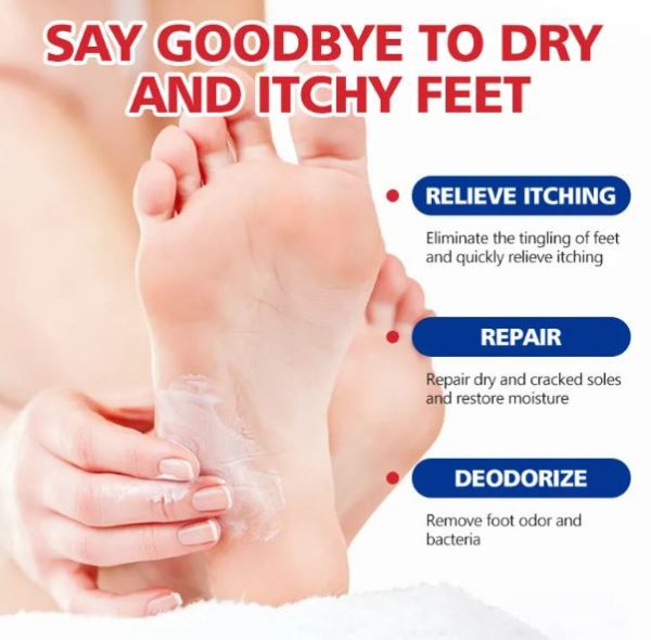 Aichun Beauty Moisturizing Foot Cream, Dead Skin Care Cream, Foot Removal Cream For Cracked Heels 20g Ac2042