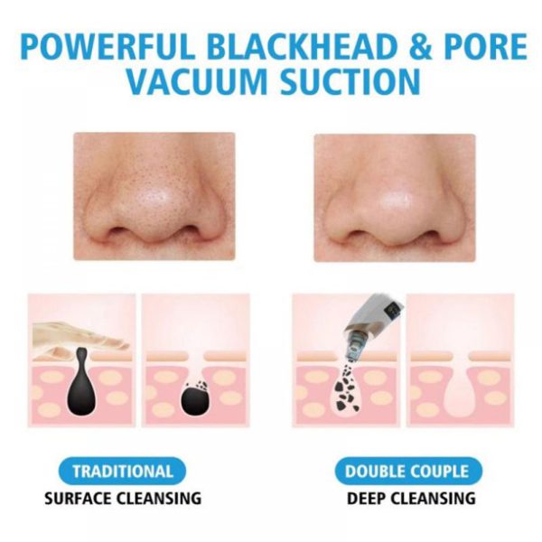 Electric Suction Blackhead Instrument Home Beauty Instrument Blackhead Pore Cleaning.